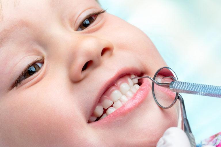 El cuidado dental los primeros años de vida