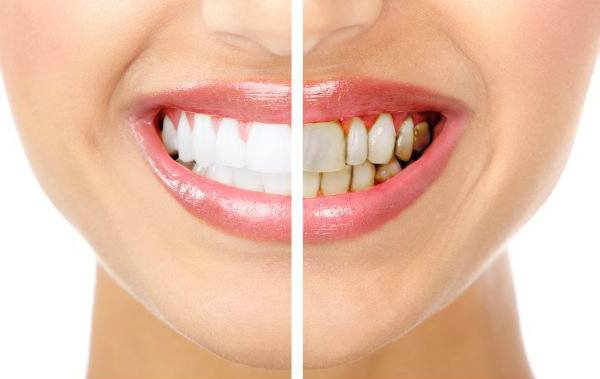 La enfermedad Periodontal ¿La conoces?