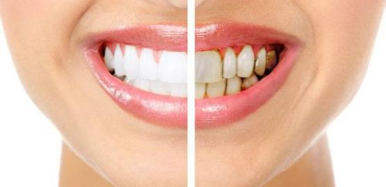 La enfermedad Periodontal ¿La conoces?