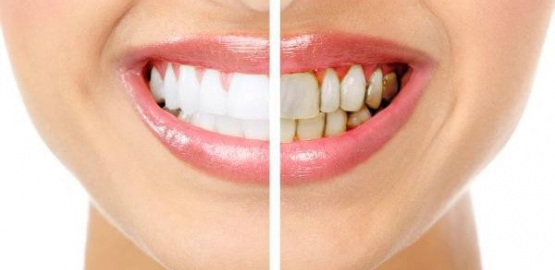 La enfermedad Periodontal ¿La conoces?