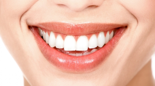 Blanqueamiento Dental